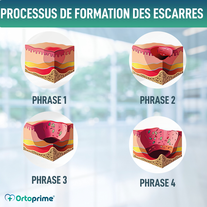 Coussin Antiescarres Viscoélastique pour Coccyx 60kg/m3