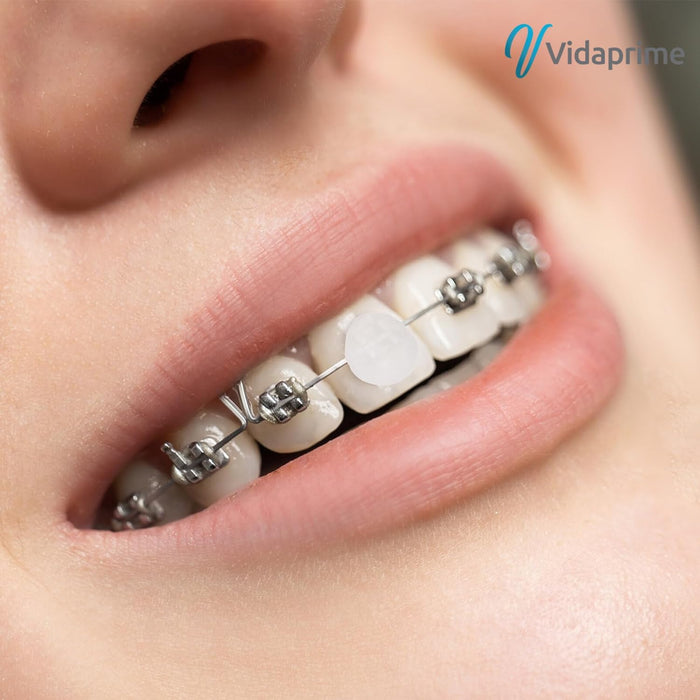 Cire Dentaire pour Brackets Orthodontie | Pack 10 Étuis