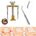 kit-de-correccion-de-unas-ortoprime